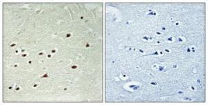 Immunohistochemical analysis of paraffin-embedded human brain using Anti-DDX51 Antibody 1:100 (4°C overnight). The right hand panel represents a negative control, where the antibody was pre-incubated with the immunising peptide