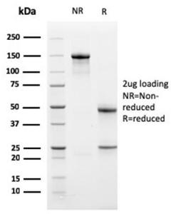 SDS-PAGE analysis of Anti-Bcl-X Antibody [BCL2L1/2406] under non-reduced and reduced conditions; showing intact IgG and intact heavy and light chains, respectively. SDS-PAGE analysis confirms the integrity and purity of the antibody.