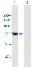 Anti-SLC25A13 Mouse Polyclonal Antibody