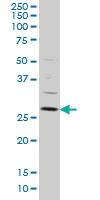 Anti-DKK1 Mouse Monoclonal Antibody [clone: 4C10]