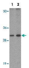 Anti-AP3S1 Rabbit Polyclonal Antibody