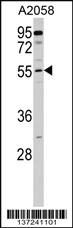 Anti-CNDP2 Rabbit Polyclonal Antibody