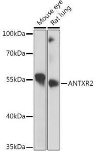 Anti-ANTXR2/CMG-2 Rabbit Polyclonal Antibody