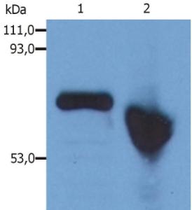 Western Blotting analysis of human alpha-Fetoprotein in Hep G2 human hepatocellular carcinoma cell line Lane 1: Immunostaining with Anti-alpha Fetoprotein Antibody (A85533) (reducing conditions) Lane 2: Immunostaining with Anti-alpha Fetoprotein Antibody (A85533) (non-reducing conditions)