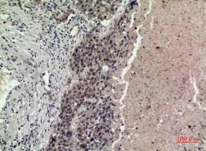 Immunohistochemical analysis of paraffin-embedded human lung using Anti-FGF16 Antibody