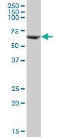 Anti-SLC25A13 Mouse Polyclonal Antibody