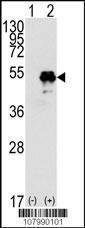 Anti-TP53 Rabbit Polyclonal Antibody (APC (Allophycocyanin))