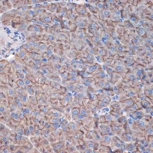 Immunohistochemistry analysis of paraffin-embedded mouse pancreas using Anti-CTNNA3 Antibody [ARC2463] (A305581) at a dilution of 1:100 (40X lens). Perform microwave antigen retrieval with 10 mM Tris/EDTA buffer pH 9.0 before commencing with IHC staining protocol