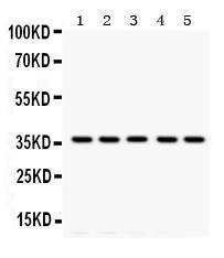 Anti-Tropomyosin Mouse Monoclonal Antibody [clone: TM-36]