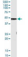 Anti-CPB1 Antibody Pair