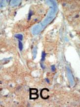 Anti-FLT3 Rabbit Polyclonal Antibody (HRP (Horseradish Peroxidase))