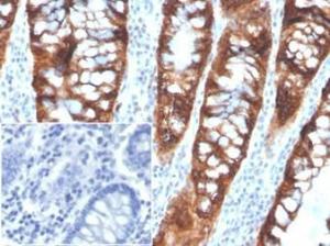 Immunohistochemical analysis of formalin-fixed, paraffin-embedded human colon tissue using Anti-PDGFB Antibody [PDGFB/3072]. Inset: PBS instead of the primary antibody. Secondary antibody negative control.