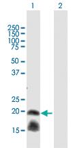 Anti-IL1RN Rabbit Polyclonal Antibody