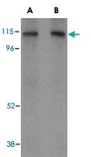 Anti-LAMP2 Rabbit Polyclonal Antibody