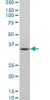 Anti-DKK1 Mouse Monoclonal Antibody [clone: 4C10]