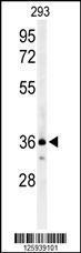 Anti-CCR1 Rabbit Polyclonal Antibody