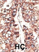 Anti-MAGEA11 Rabbit Polyclonal Antibody