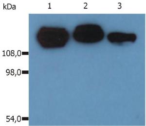 Western Blotting analysis (non-reducing conditions) of isolated peripheral blood lymphocytes of various species using Anti-CD29 Antibody (A85541). Lane 1: Lysate of human PBL. Lane 2: Lysate of canine PBL. Lane 3: Lysate of porcine PBL