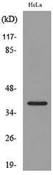 Anti-CXCR6 antibody