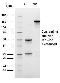 Anti-Carboxypeptidase A1 Mouse Monoclonal Antibody [clone: CPA1/2711]