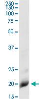 Anti-IL1RN Rabbit Polyclonal Antibody