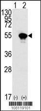 Anti-TP53 Rabbit Polyclonal Antibody (AP (Alkaline Phosphatase))