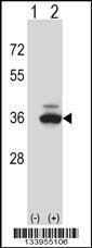 Anti-PPP1CB Rabbit Polyclonal Antibody (APC (Allophycocyanin))