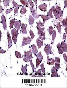 Anti-NTRK1 Rabbit Polyclonal Antibody (PE (Phycoerythrin))