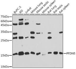 Western blot analysis of extracts of various cell lines, using Anti-PFDN5 Antibody [ARC2111] (A306658) at 1:1,000 dilution