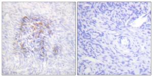 Immunohistochemical analysis of paraffin-embedded human ovary using Anti-IREB1 (phospho Ser138) Antibody. The right hand panel represents a negative control, where the Antibody was pre-incubated with the immunising peptide