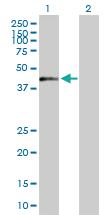 Anti-ZNF584 Mouse Polyclonal Antibody