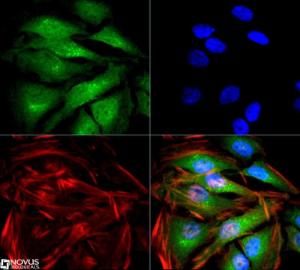 Anti-LAMP2 Mouse Monoclonal Antibody [clone: H4B4]