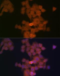 Immunofluorescence analysis of HeLa cells using Anti-PFDN5 Antibody [ARC2111] (A306658) at a dilution of 1:100 (40X lens). DAPI was used to stain the cell nuclei (blue)