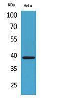 Anti-CXCR6 antibody