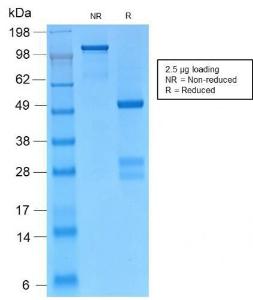 SDS-PAGE analysis of Anti-gamma Catenin Antibody [CTNG/2155R] under non-reduced and reduced conditions; showing intact IgG and intact heavy and light chains, respectively. SDS-PAGE analysis confirms the integrity and purity of the Antibody