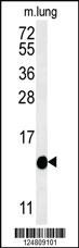 Anti-IFT20 Rabbit Polyclonal Antibody