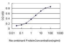 Anti-IL1RN Mouse Monoclonal Antibody [clone: M1-B9]