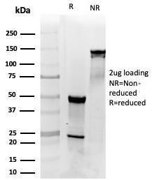 SDS-PAGE analysis of Anti-PDGFB Antibody [PDGFB/3072] under non-reduced and reduced conditions; showing intact IgG and intact heavy and light chains, respectively. SDS-PAGE analysis confirms the integrity and purity of the antibody.