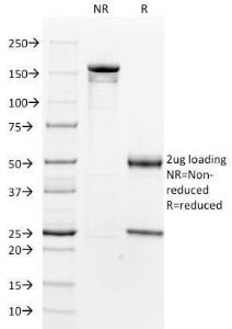 SDS-PAGE analysis of Anti-alpha Smooth Muscle Actin Antibody [1A4] under non-reduced and reduced conditions; showing intact IgG and intact heavy and light chains, respectively. SDS-PAGE analysis confirms the integrity and purity of the antibody