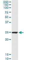 Anti-BAG2 Polyclonal Antibody Pair