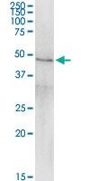 Anti-CPB1 Polyclonal Antibody Pair