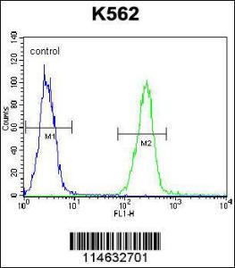 Anti-tRNA Synthetase, Alanyl Rabbit Polyclonal Antibody