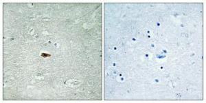 Immunohistochemical analysis of paraffin-embedded human brain using Anti-HER3 (phospho Tyr1328) Antibody 1:100 (4°C overnight). The right hand panel represents a negative control, where the antibody was pre-incubated with the immunising peptide.