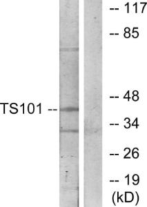 Western blot analysis of lysates from COS7 cells using Anti-TS101 Antibody. The right hand lane represents a negative control, where the antibody is blocked by the immunising peptide