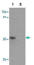 Anti-PRR5L Rabbit Polyclonal Antibody