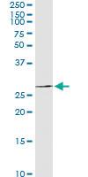 Anti-GALNT9 Polyclonal Antibody Pair