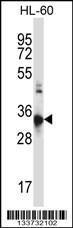 Anti-CCR10 Rabbit Polyclonal Antibody (HRP (Horseradish Peroxidase))