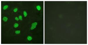 Immunofluorescence analysis of HeLa cells using Anti-B-Myb Antibody. The right hand panel represents a negative control, where the antibody was pre-incubated with the immunising peptide.