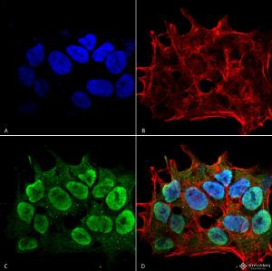 Immunocytochemistry/Immunofluorescence analysis of human neuroblastoma cell line (SK-N-BE, fixed in 4% formaldehyde for 15 min at room temperature, using Anti-SHANK3 Antibody [S367-51] (A304719), at 1:100 for 60 minutes at room temperatur