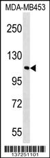 Anti-FAM65B Rabbit Polyclonal Antibody